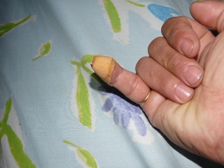 Little finger bitten by Indon rat