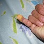 Little finger bitten by Indon rat